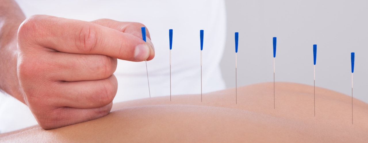physical-therapy-clinic-dry-needling-wise-physical-therapy-anchorage-ak
